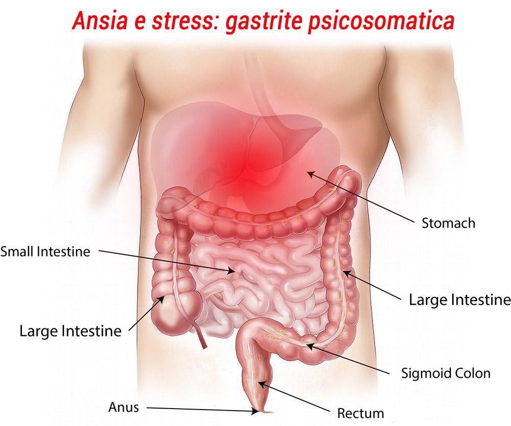 Gastrite-psicosomatica-psicologo-padova